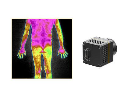 Caméras infrarouges thermiques de représentation pour les solutions médicales de thermographie